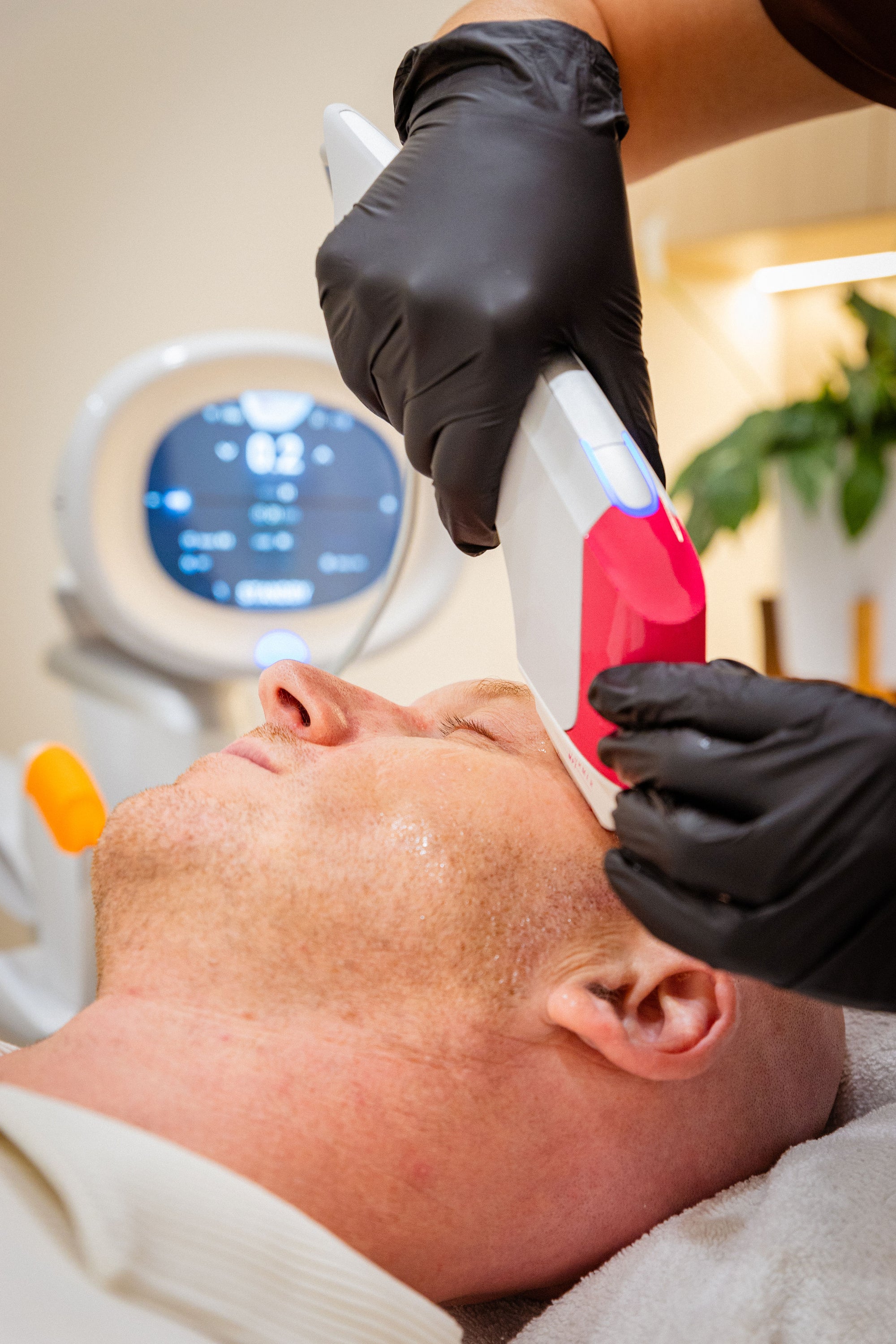 Ultraformer MPT Lower Face