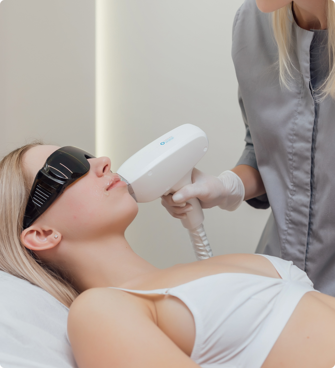 Laser Hair Removal: Face | Chin – GLO Laser